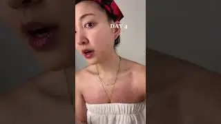 how long it takes to treat my pimple... 