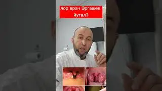 йутални яна бир сабаби?
