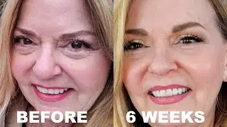 Puffiness? IBS? Joint Pain? - Gut Health Over 50!