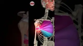 The Pectoralis Major Twist 