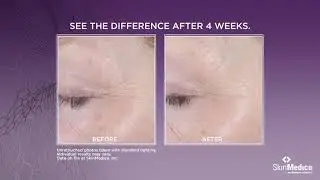 Total Defense + Repair SPF