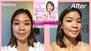 BRILLIANT SKIN REJUVENATING SET REVIEW | 1 week