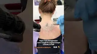 Hapus Tatto Cewek Cantik Di Punggung ,😭 Nangis Kah??? 