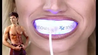BEST TEETH WHITENING KIT | Fit Now with Basedow #162