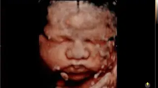 Our last Ultrasound before meeting Baby Boy!