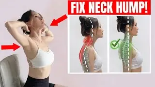 Fix Neck Hump, Forward Head, Tech Neck & Rounded Shoulders I 10 Min Posture Routine No Equipment