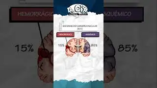 ECV hemorrágico e isquémico