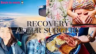SURGERY RECOVERY {Surgery aftercare. Changing bandages and returning to work as a Flight Attendant!