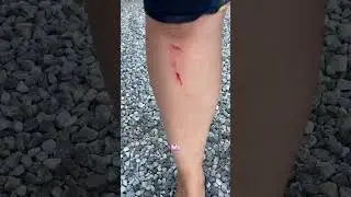 Ho smesso di fare surf d’estate solo un costume