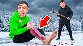 dieser YOUTUBER hat mein BEIN GEBROCHEN! 😭🚑