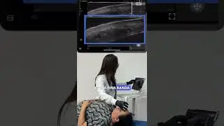 Mediexpert: Cómo ver la Sleb