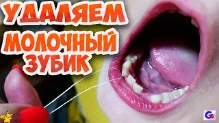 ВЫРЫВАЕМ НЕНУЖНЫЙ ЗУБ Веселое Видео
