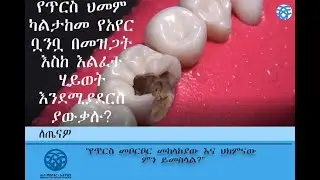 የጥርስ መቦርቦር መከላከያው እና ህክምናው