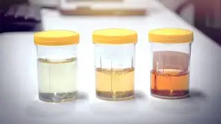 Does pee color matter?