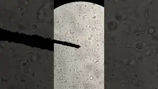 Sperm Under the Microscope: See What's Inside! #shorts