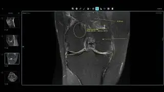 Dicom viewer