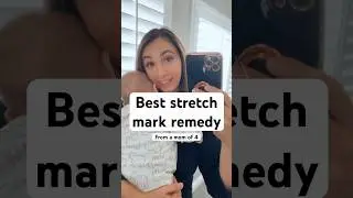 Best stretch mark remedy (from a mom of 4)