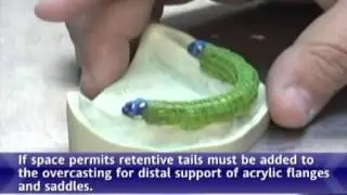 Overcasting Resin Overlay