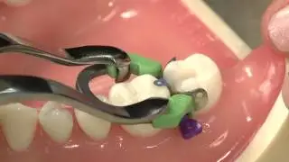 Triodent V3 Matrix System Demo with Two Year Warranty