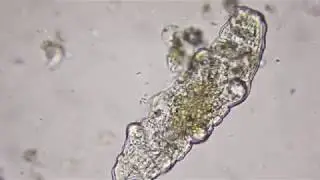 Tardigrade @ 400x magnification