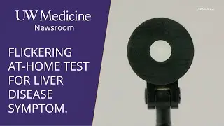 How an at-home vision test can screen for common liver disease symptom | UW Medicine