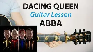 Dancing Queen: ABBA 🎸 Acoustic Lesson & Play-Along