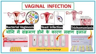 Vaginal infection हिंदी में समझे ll Vaginal Discharge ll Bacterial Vaginosis ll Trichomoniasis ll