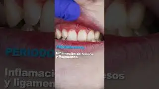 ¿Cuáles son las enfermedades bucales más comunes?