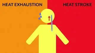 Safety Monday 05132024 Working in the Heat