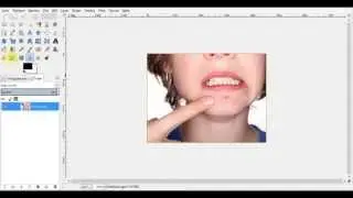 How To Remove Acne From A Photo Using GIMP