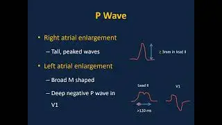 Pediatric ECG Interpretations