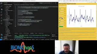Heart ECG Signal Feature Extraction Tool Development using Neurokit2 Flask Numpy and GPT4