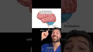 “Randomly Checking if I Have a Brain Tumour” 