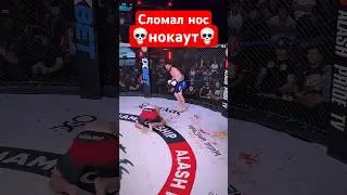 Сломал нос с одного удара 🙀🙀🙀🙀 