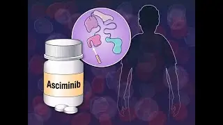 Asciminib in Newly Diagnosed CML | NEJM
