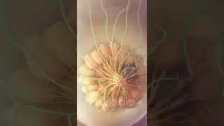 Breast cancer metastasis animation | #medicalanimation #breastcancer #cancer #oncology