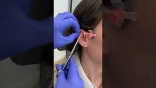 Forward helix piercing szúrás