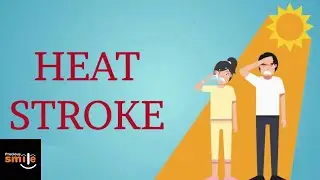 sun strock | heat strock | sunstroke prevention | sun stroke signs and symptoms