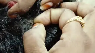 licepicking in telugu