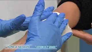 Le Ustioni