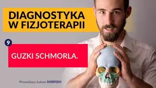 Guzki Schmorla. Diagnostyka w fizjoterapii. Odcinek 9