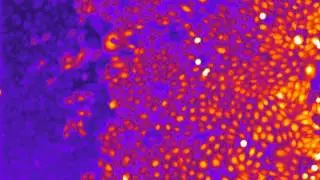 Calcium imaging in keratinocytes with Fluo4-AM dye