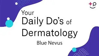 Blue Nevus - Daily Do's of Dermatology