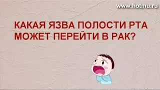 Лечение рака: Злокачественное перерождение язвенного стоматита