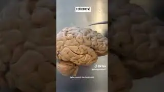 Psicólogo e o cérebro como é nosso cérebro #psicologia #neuroanatomia
