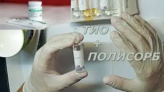 МОЩНАЯ ДЕТОКСИКАЦИЯ ПРИ ПСОРИАЗЕ: ТИОСУЛЬФАТ НАТРИЯ + ПОЛИСОРБ 
