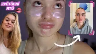 Nechala jsem si ZVĚTŠIT rty?! Bylo to dobré rozhodnutí???