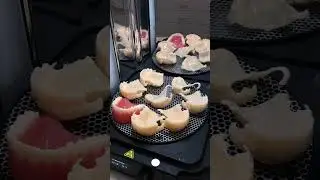 Съемные протезы на 3Д-принтере 