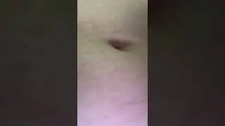 Belly noises after eating cereal and drinking Redbull
