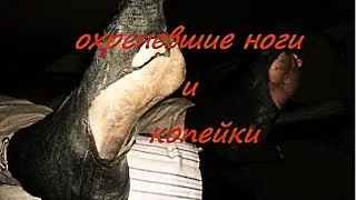 Коп от охреневших ног